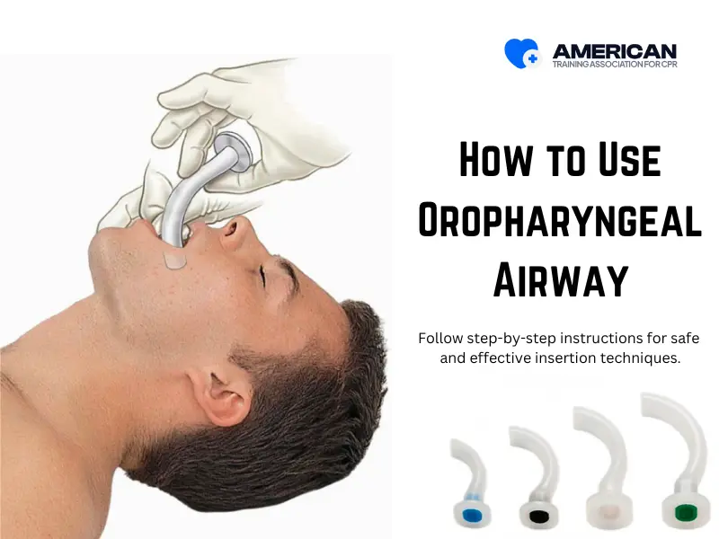 Guide to Using an Oropharyngeal Airway in Basic Life Support